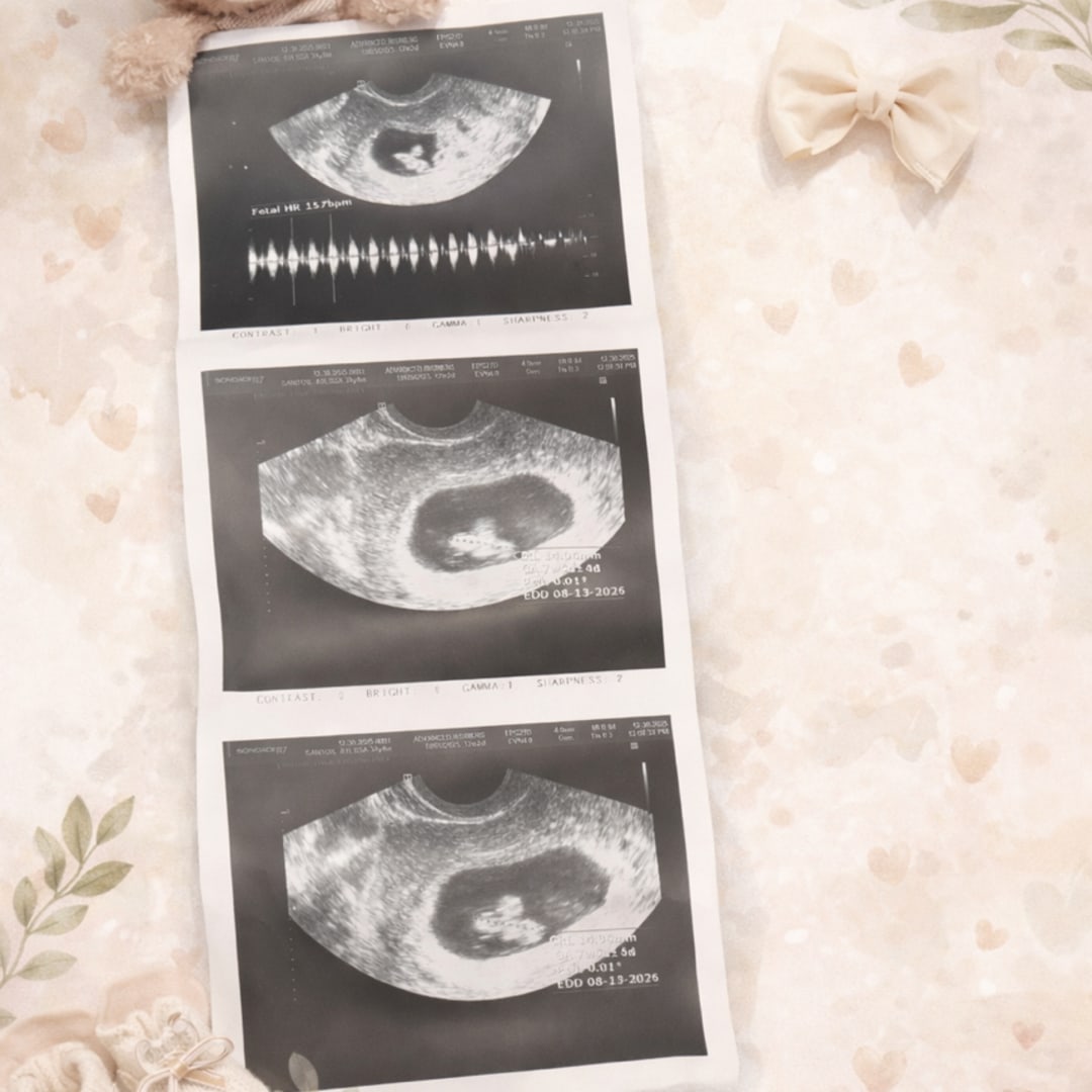 Photo shared by Alyssa for their Babylist baby registry.