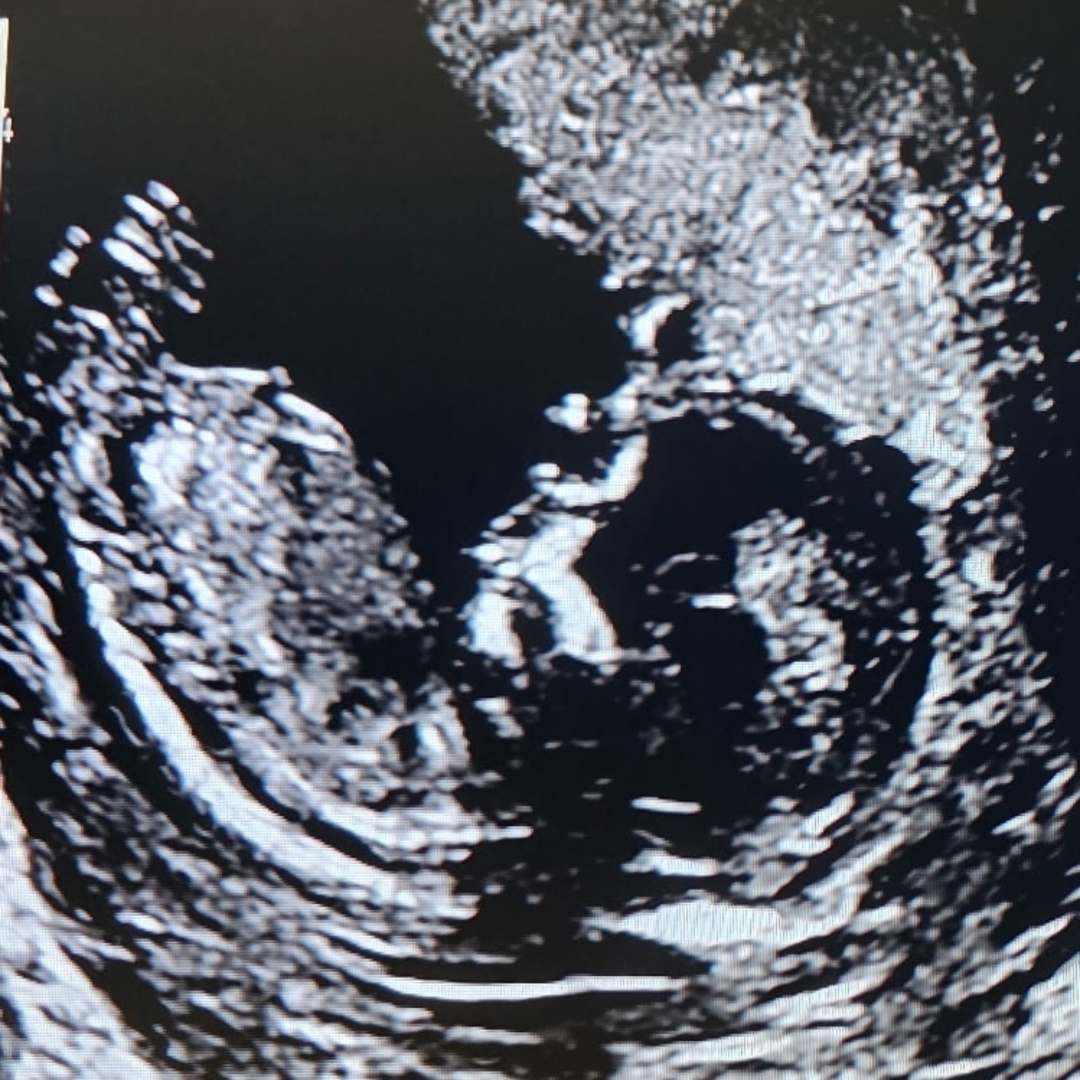 Photo shared by Ash for their Babylist baby registry.