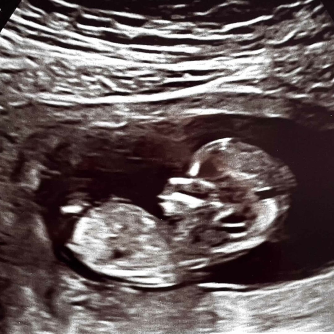 Photo shared by Franzi for their Babylist baby registry.