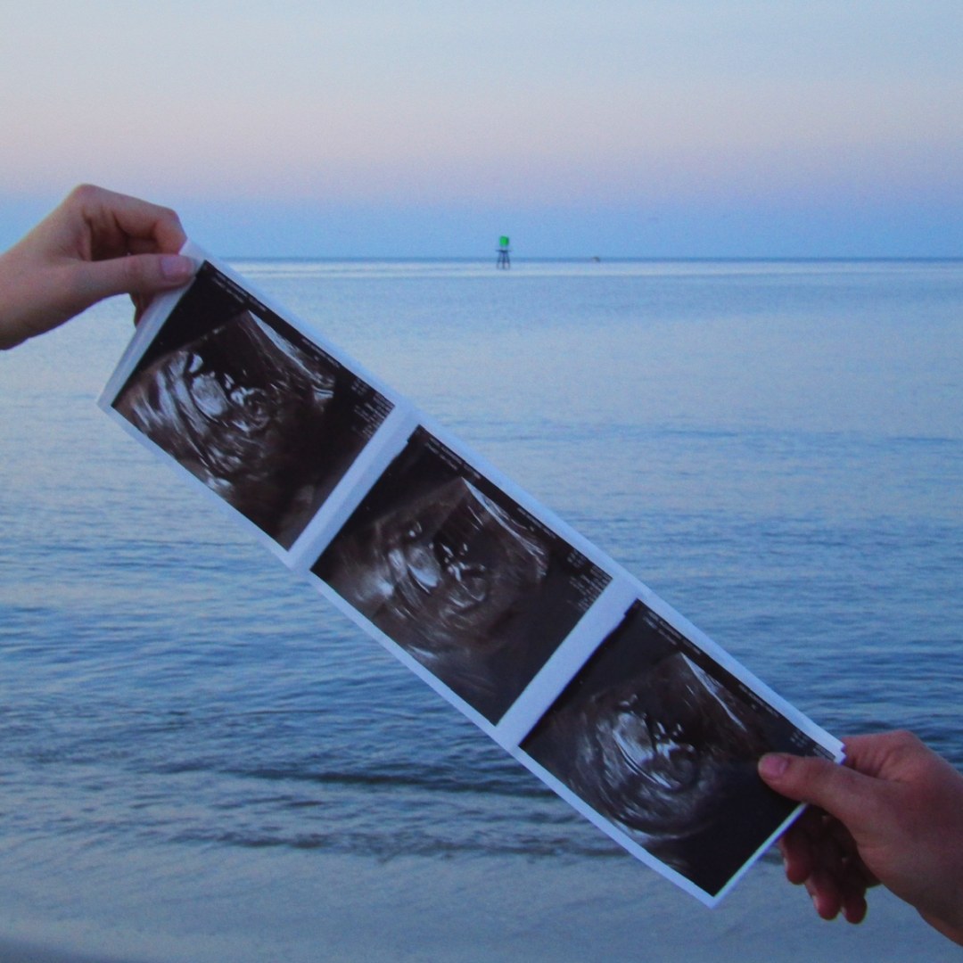Photo shared by Alex for their Babylist baby registry.