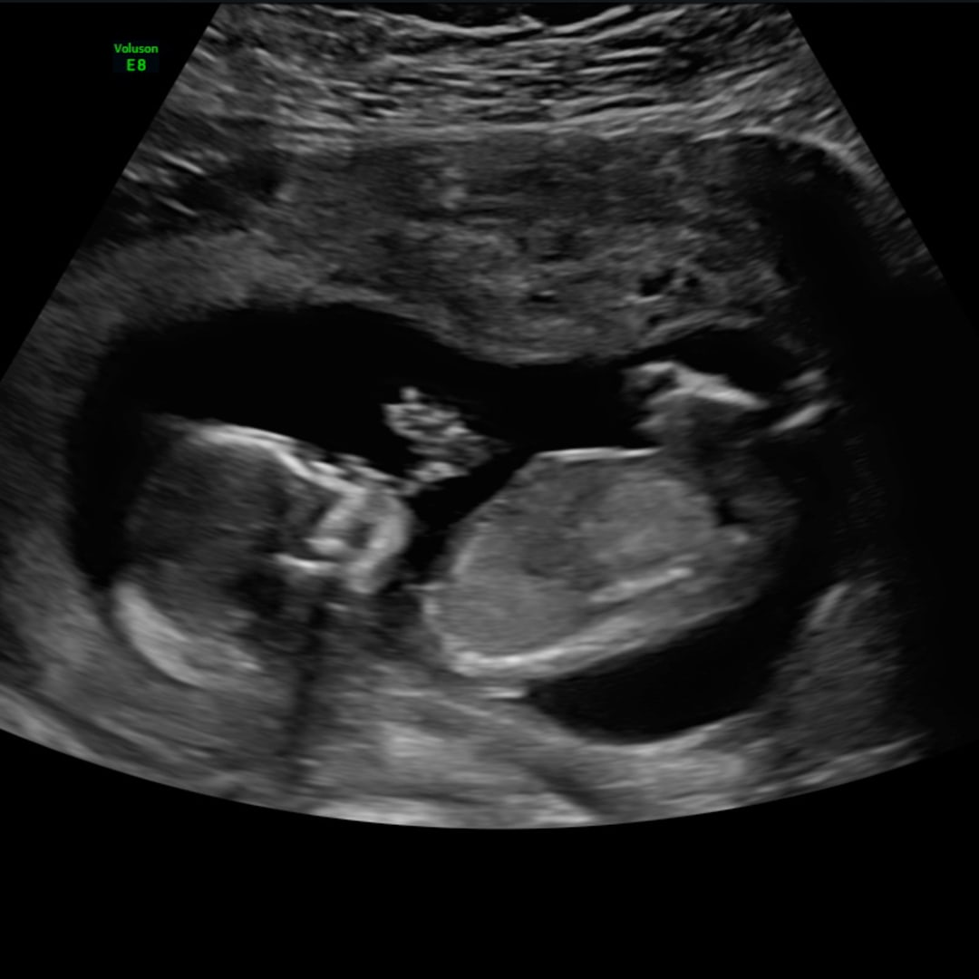 Photo shared by Lindsey for their Babylist baby registry.