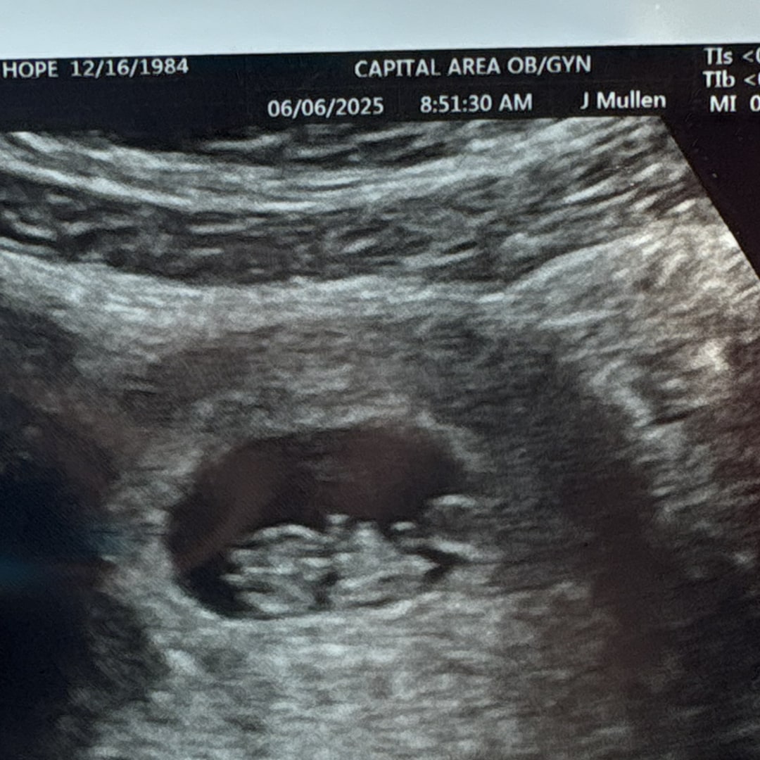Photo shared by Hope for their Babylist baby registry.