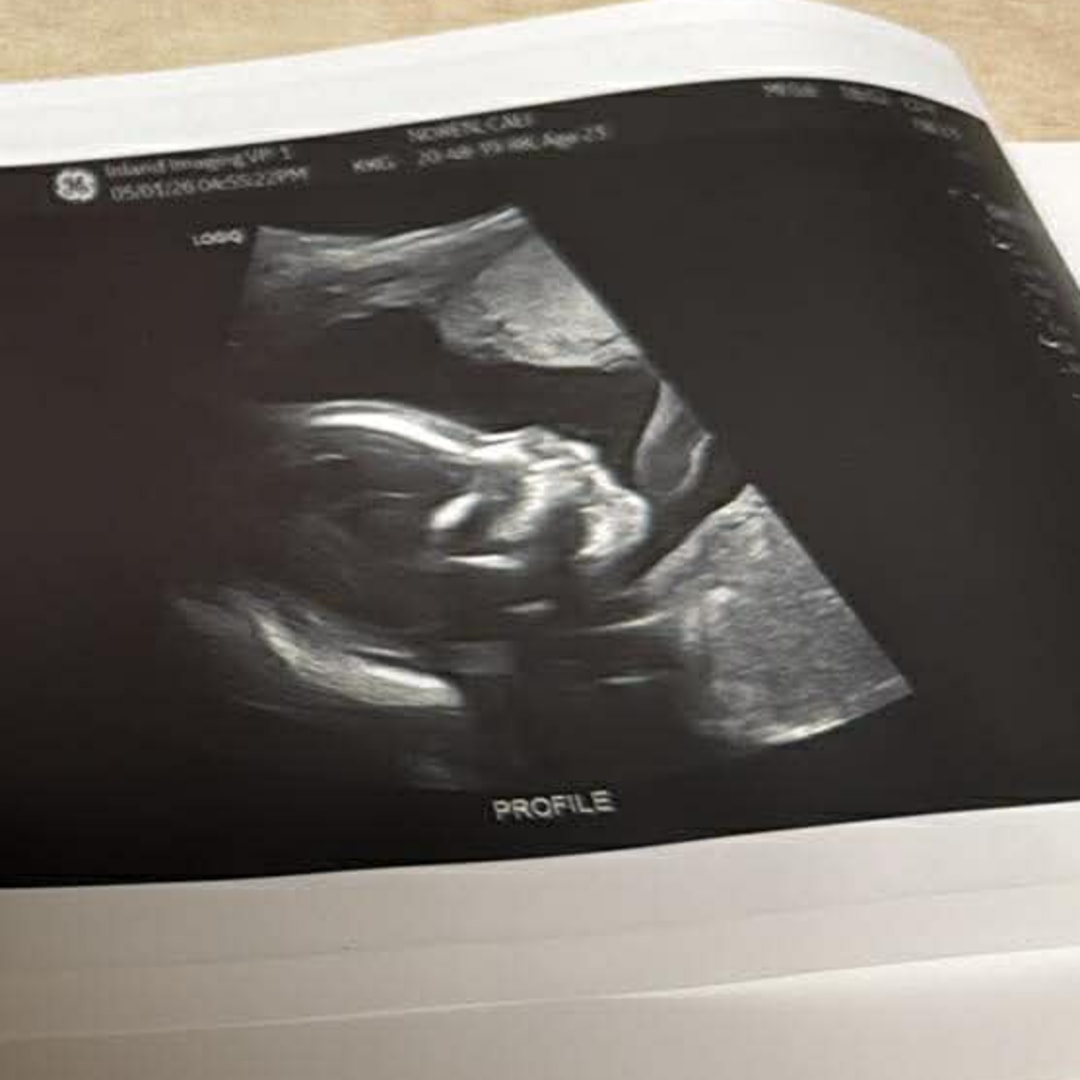 Photo shared by Cali for their Babylist baby registry.