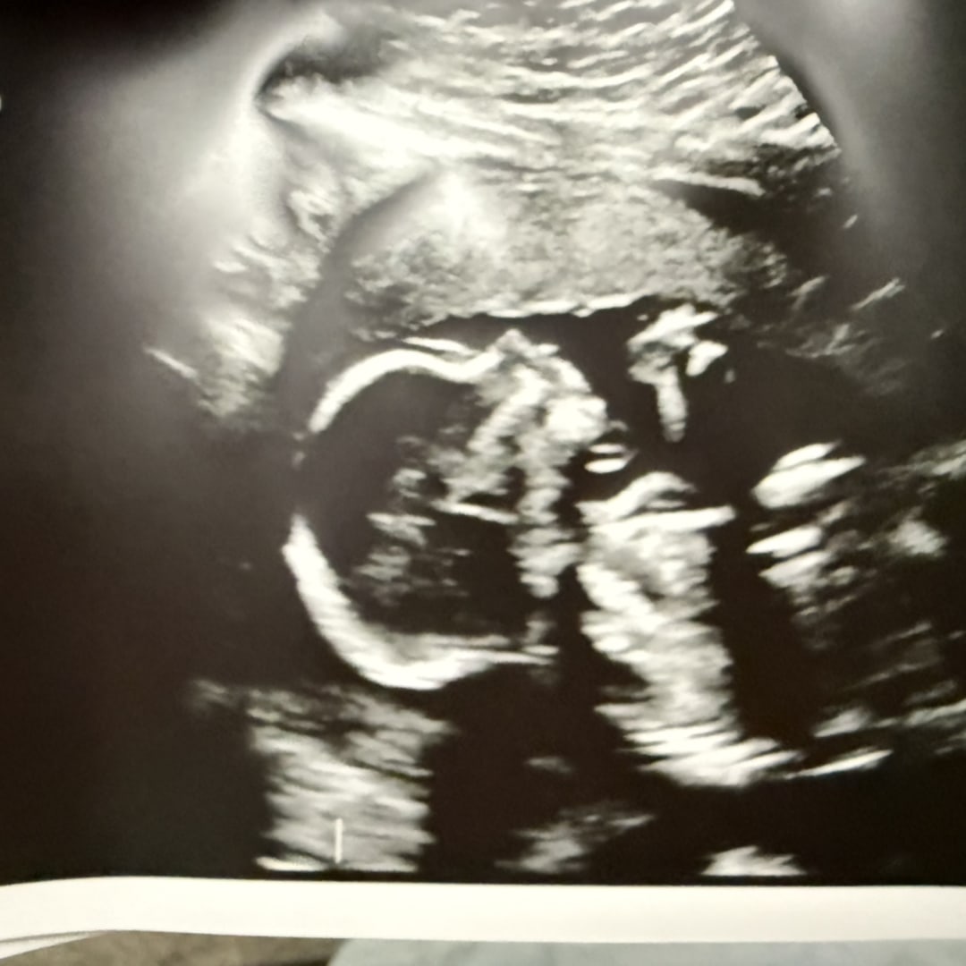 Photo shared by Ashley and Bryce for their Babylist baby registry.