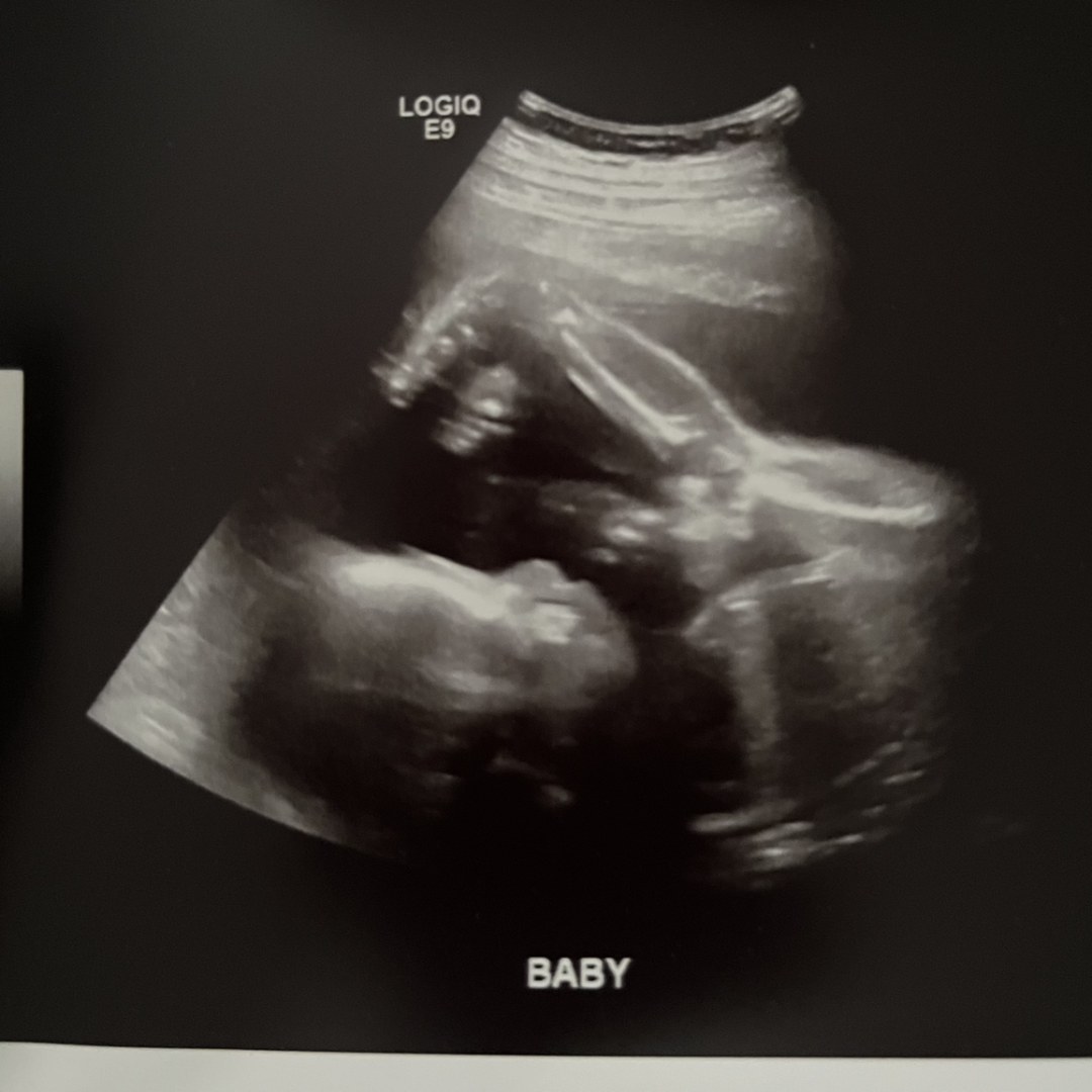 Photo shared by Rachael for their Babylist baby registry.