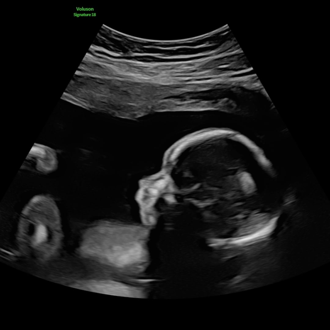 Photo shared by Kendra for their Babylist baby registry.