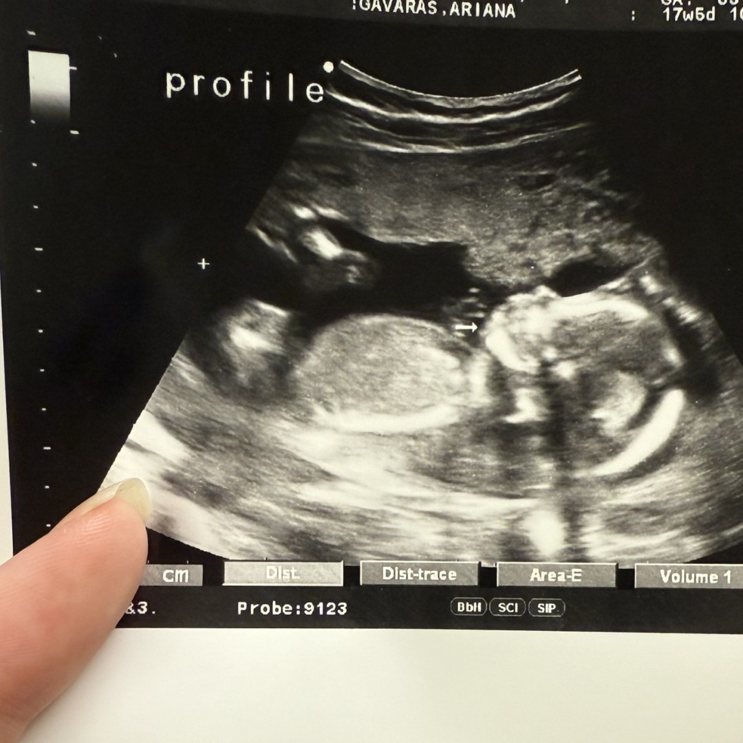 Photo shared by Ariana for their Babylist baby registry.