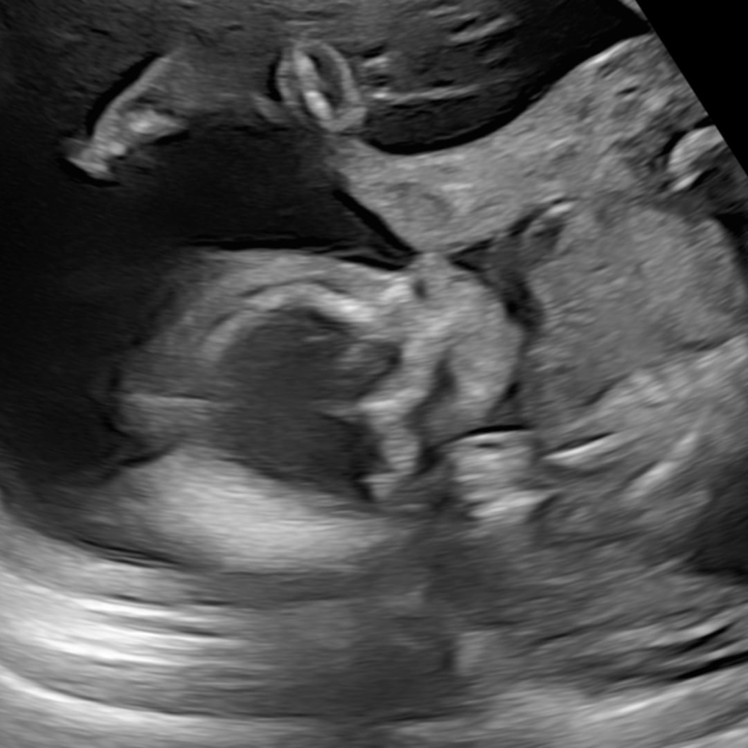 Photo shared by Skyler for their Babylist baby registry.