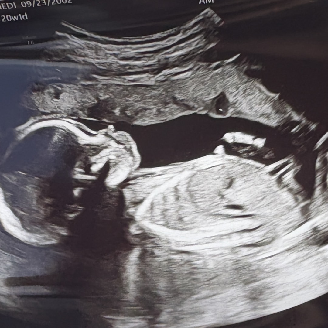 Photo shared by Kennedi for their Babylist baby registry.