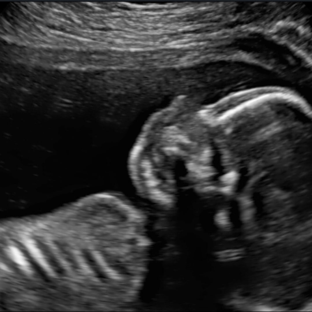 Photo shared by Bailey for their Babylist baby registry.