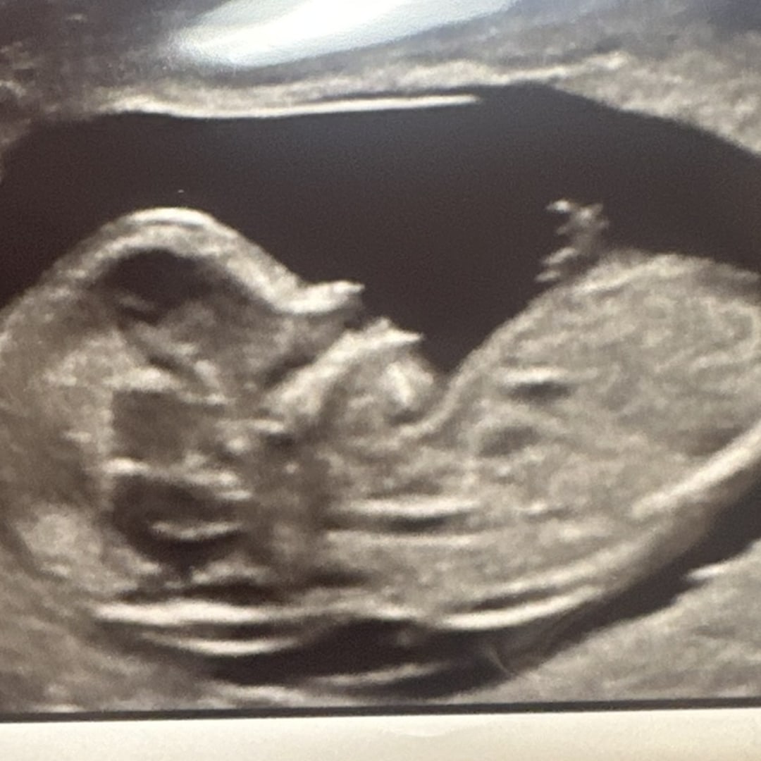 Photo shared by Brittany for their Babylist baby registry.