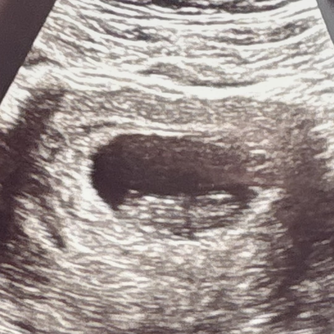 Photo shared by Phaythe for their Babylist baby registry.