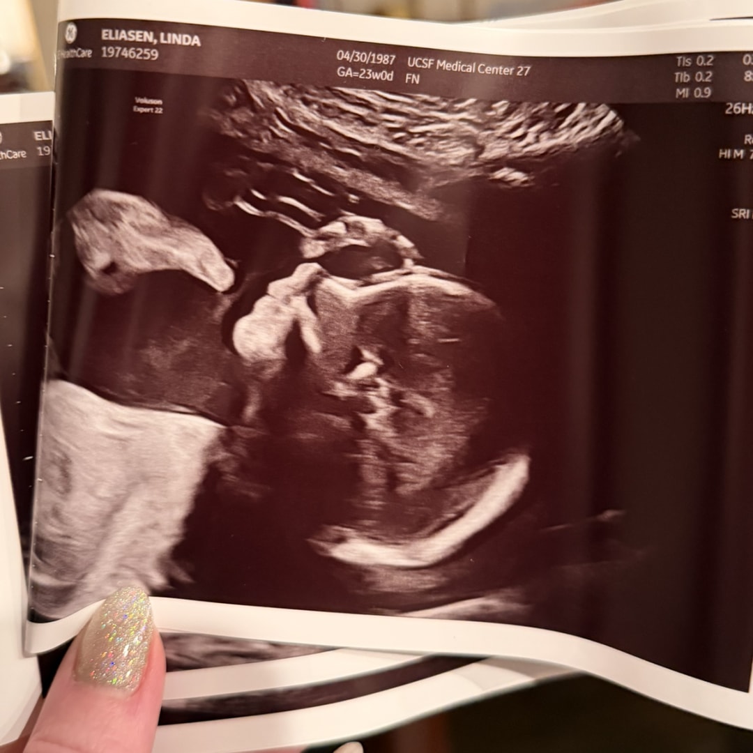 Photo shared by Linda for their Babylist baby registry.