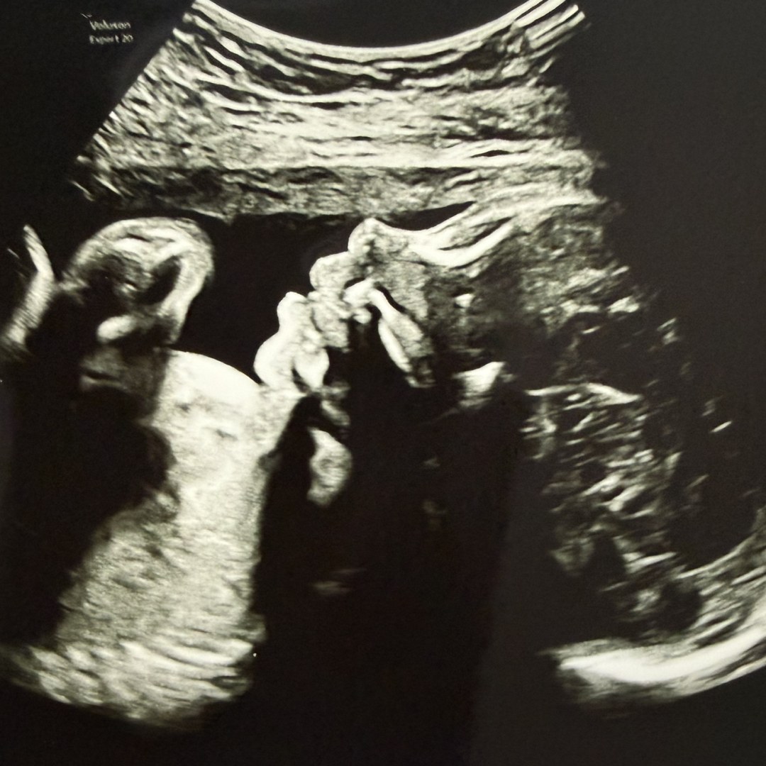 Photo shared by Amarie for their Babylist baby registry.