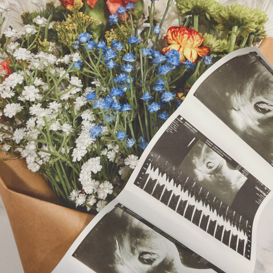 Photo shared by Giselle for their Babylist baby registry.