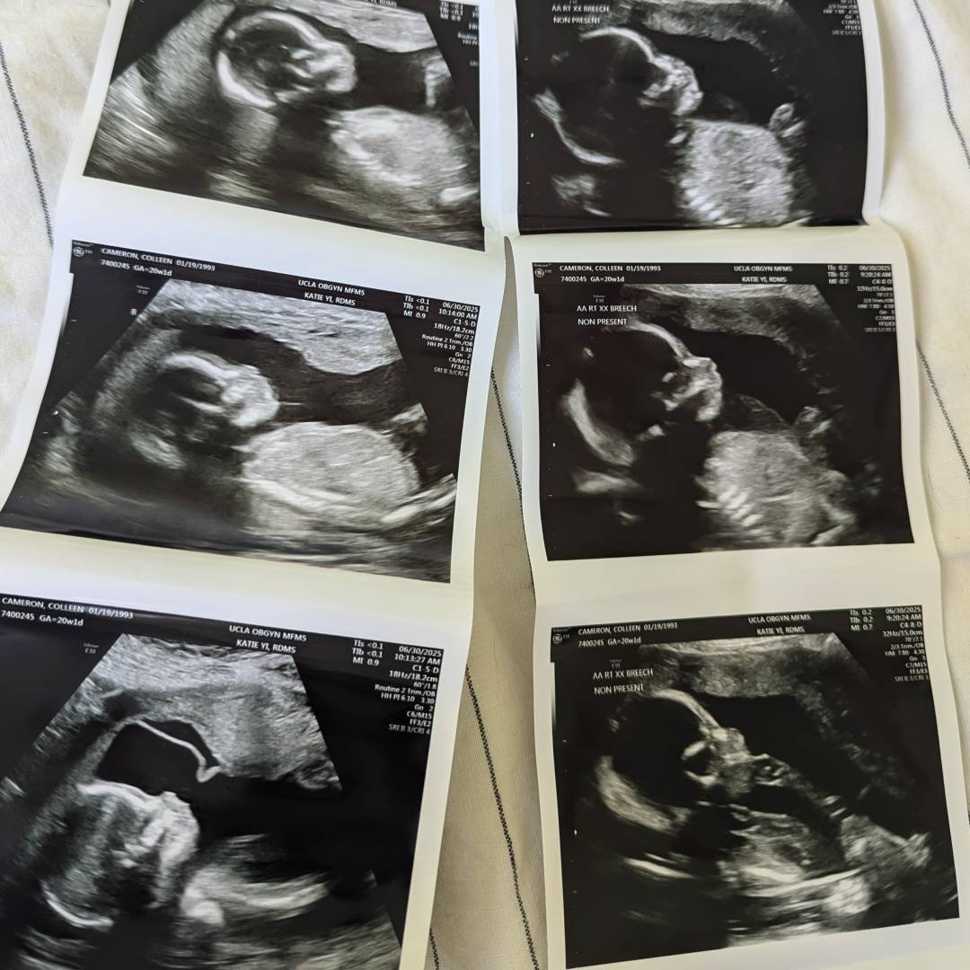 Photo shared by Colleen for their Babylist baby registry.