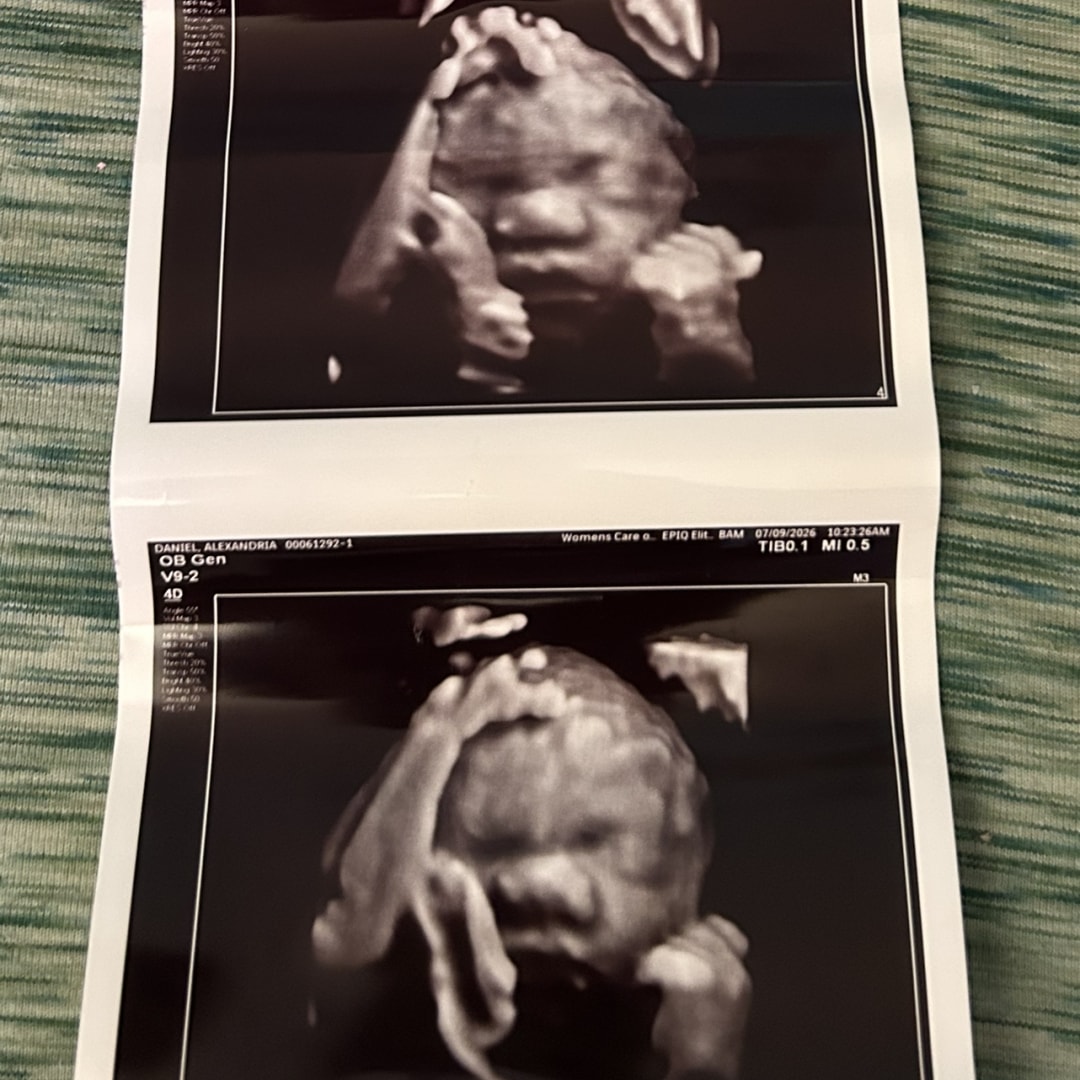 Photo shared by Alexandria for their Babylist baby registry.