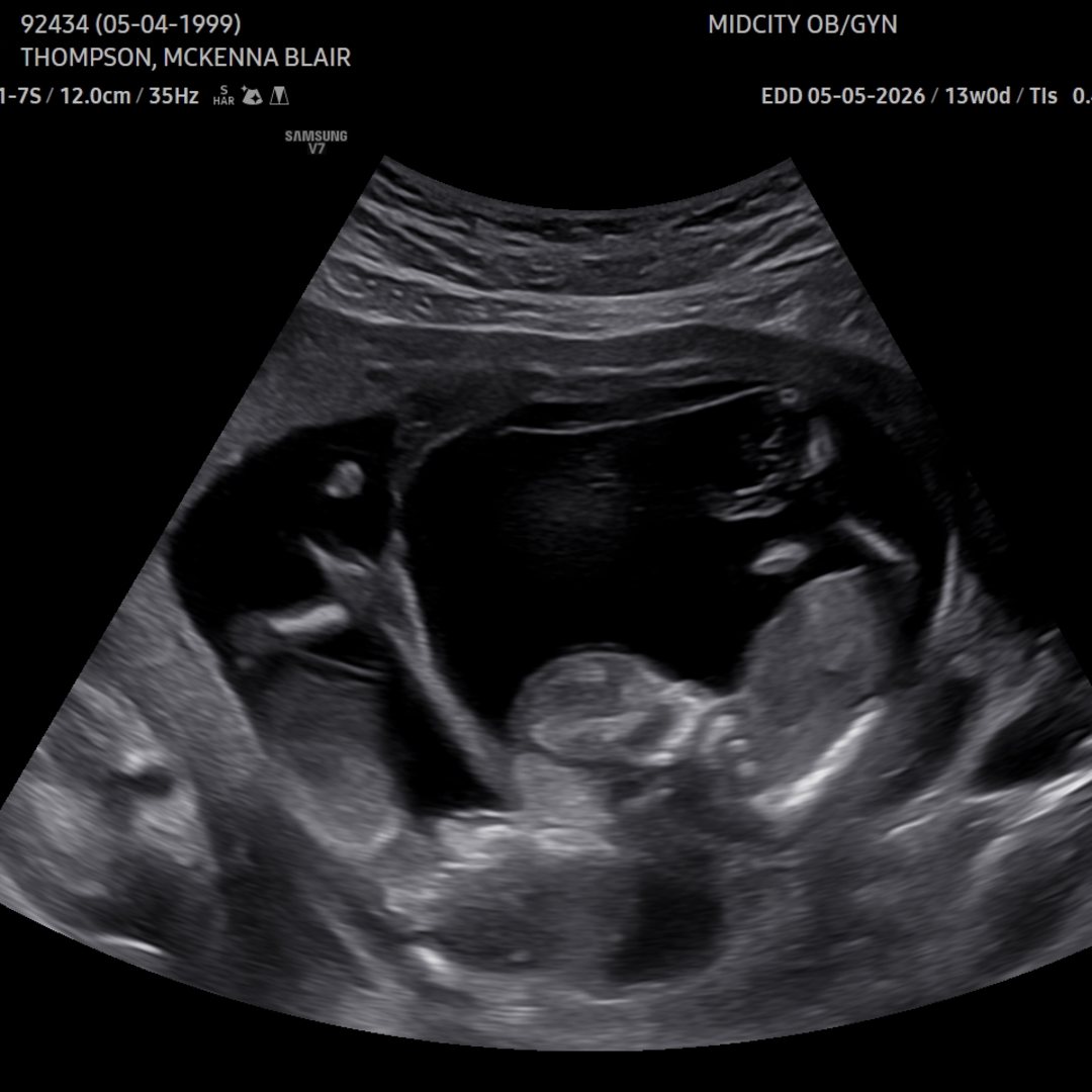 Photo shared by McKenna for their Babylist baby registry.