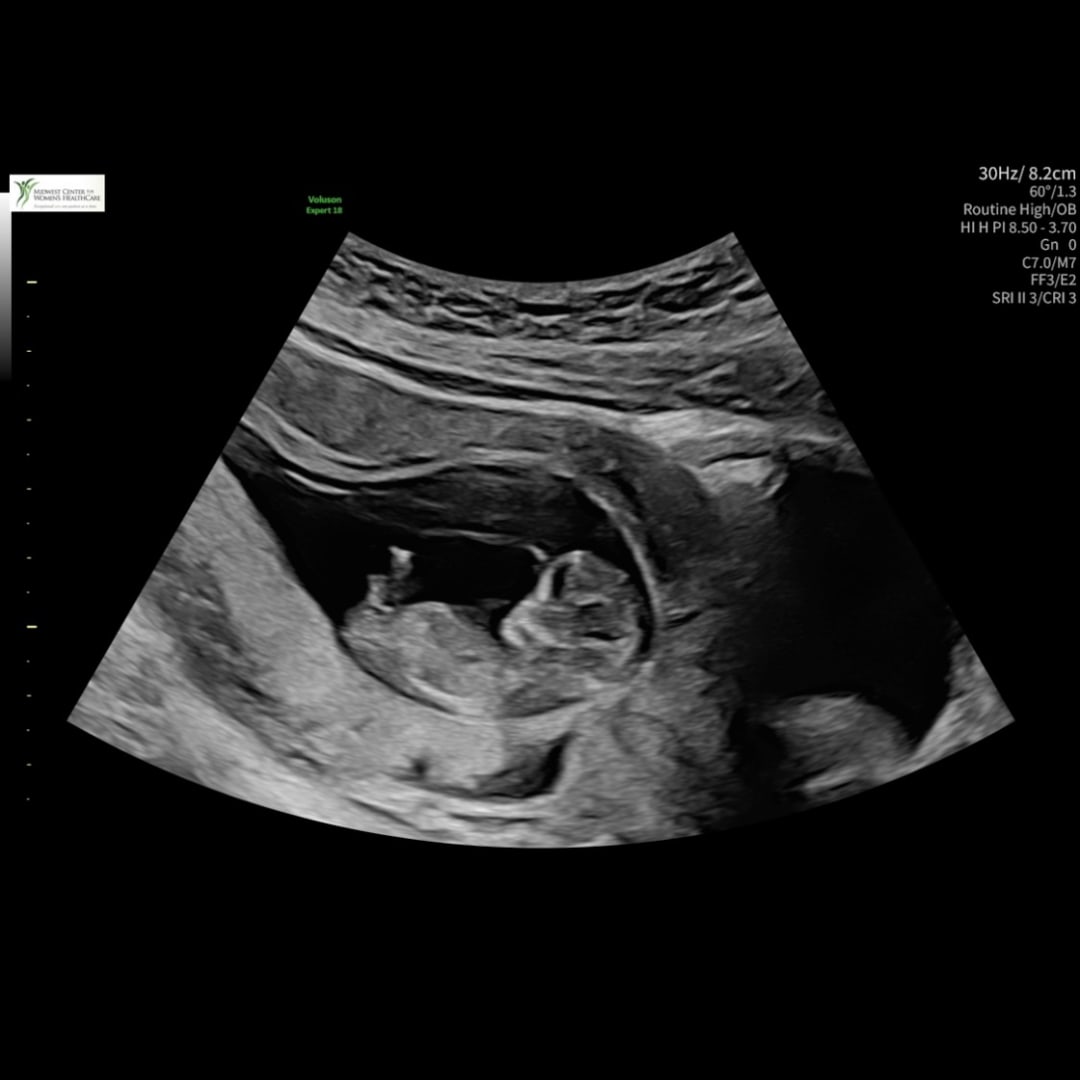 Photo shared by Marissa for their Babylist baby registry.