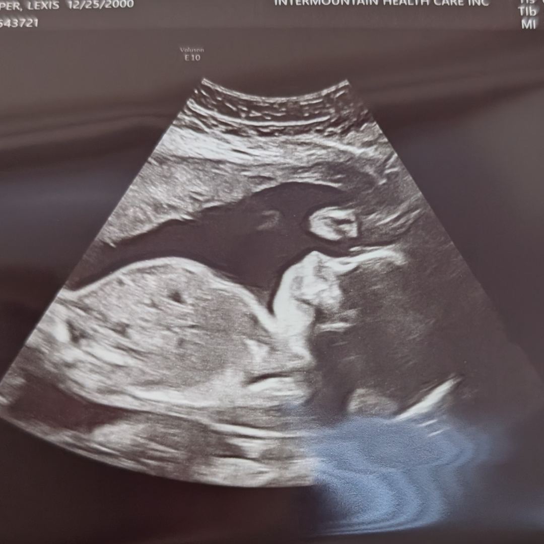 Photo shared by Lexis for their Babylist baby registry.