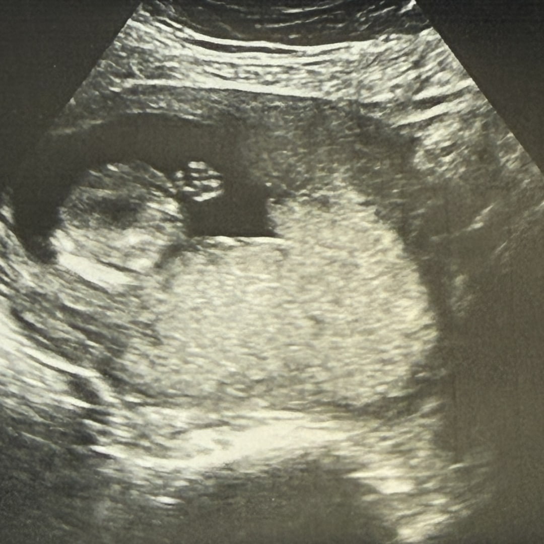 Photo shared by Hannah for their Babylist baby registry.