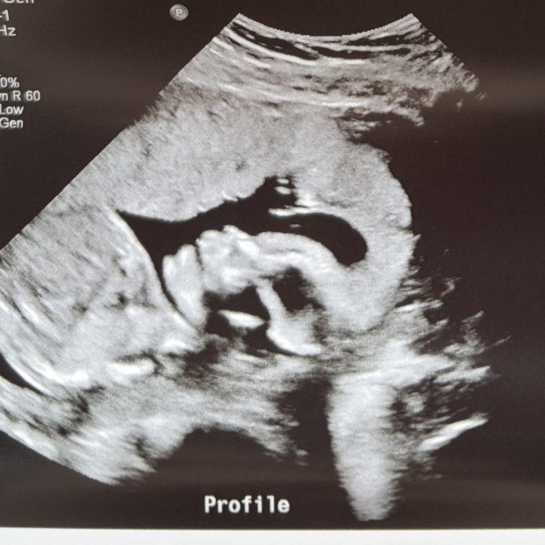 Photo shared by Bella for their Babylist baby registry.