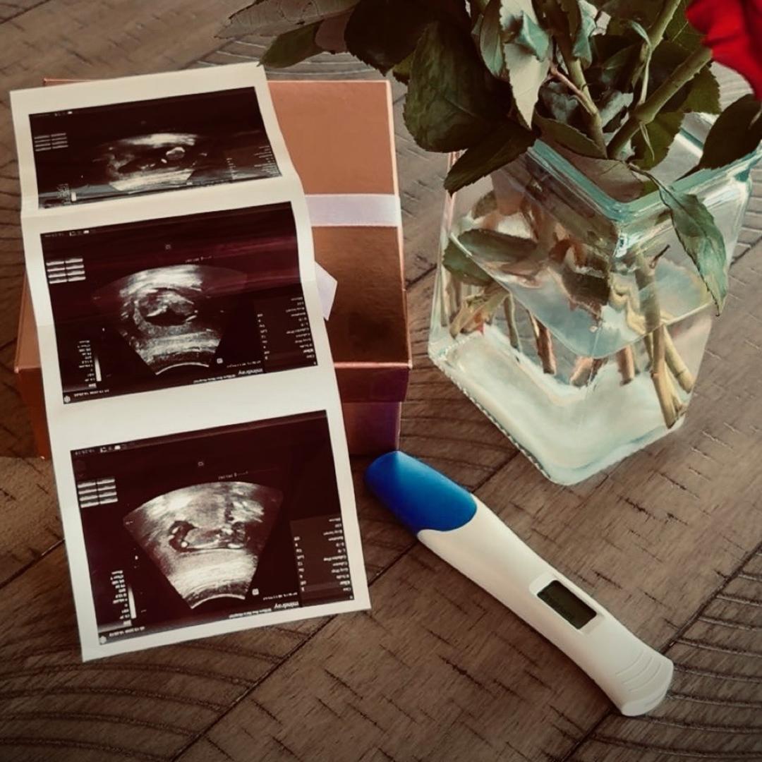 Photo shared by Aspen for their Babylist baby registry.