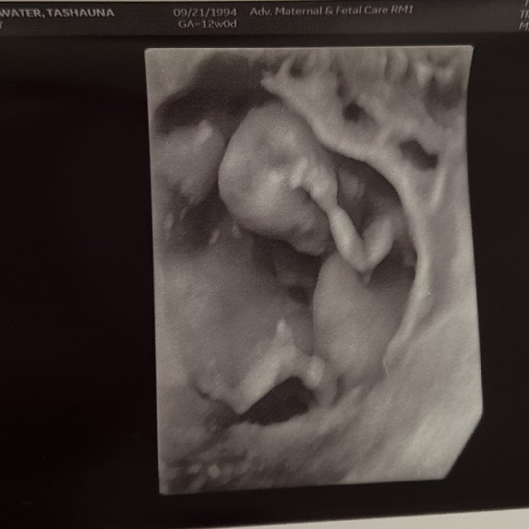 Photo shared by Tashauna for their Babylist baby registry.