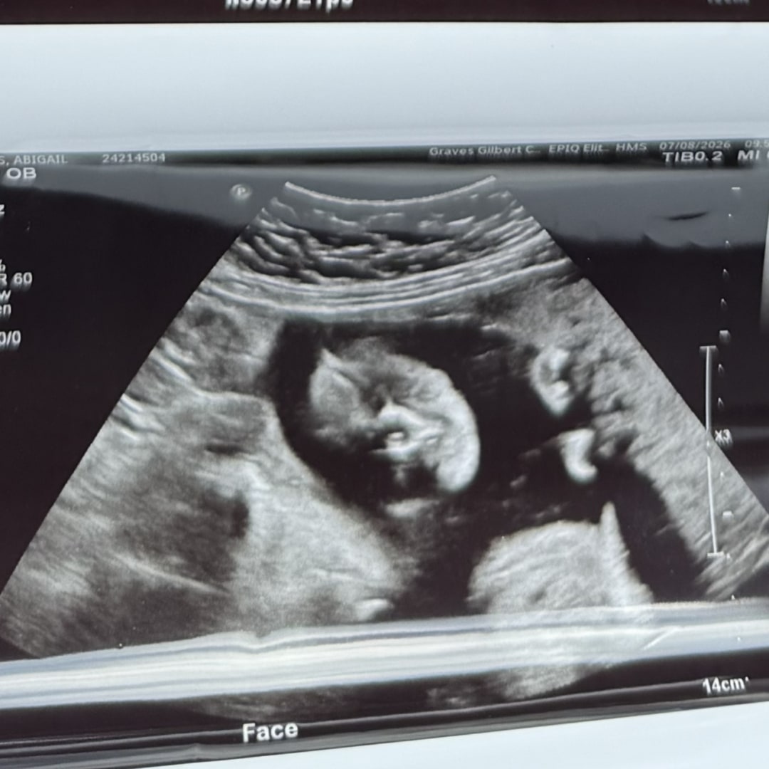 Photo shared by Abigail for their Babylist baby registry.