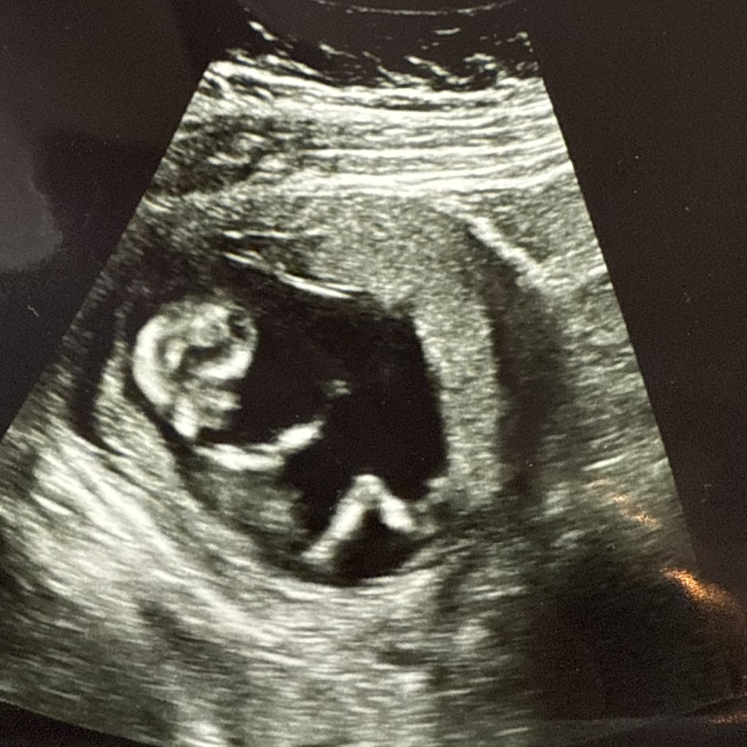 Photo shared by Lorena for their Babylist baby registry.