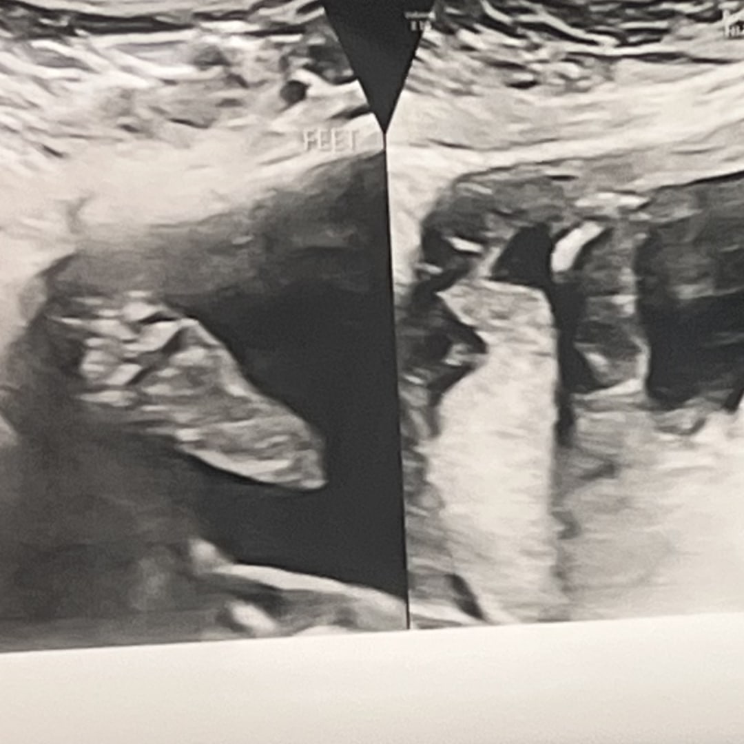 Photo shared by Alianna for their Babylist baby registry.