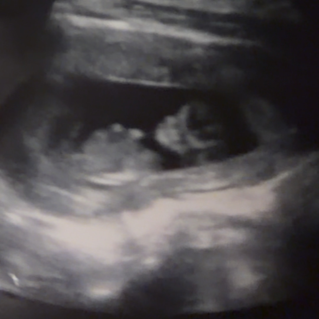 Photo shared by Chatiera for their Babylist baby registry.