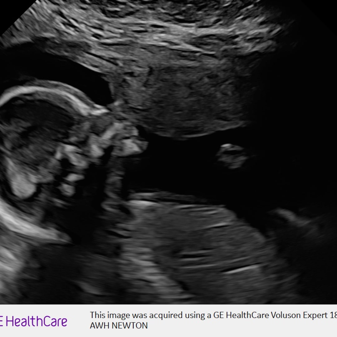 Photo shared by Emily for their Babylist baby registry.