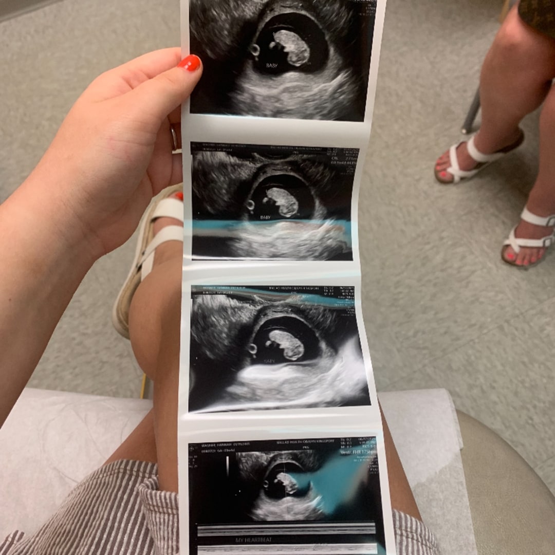 Photo shared by Hannah for their Babylist baby registry.