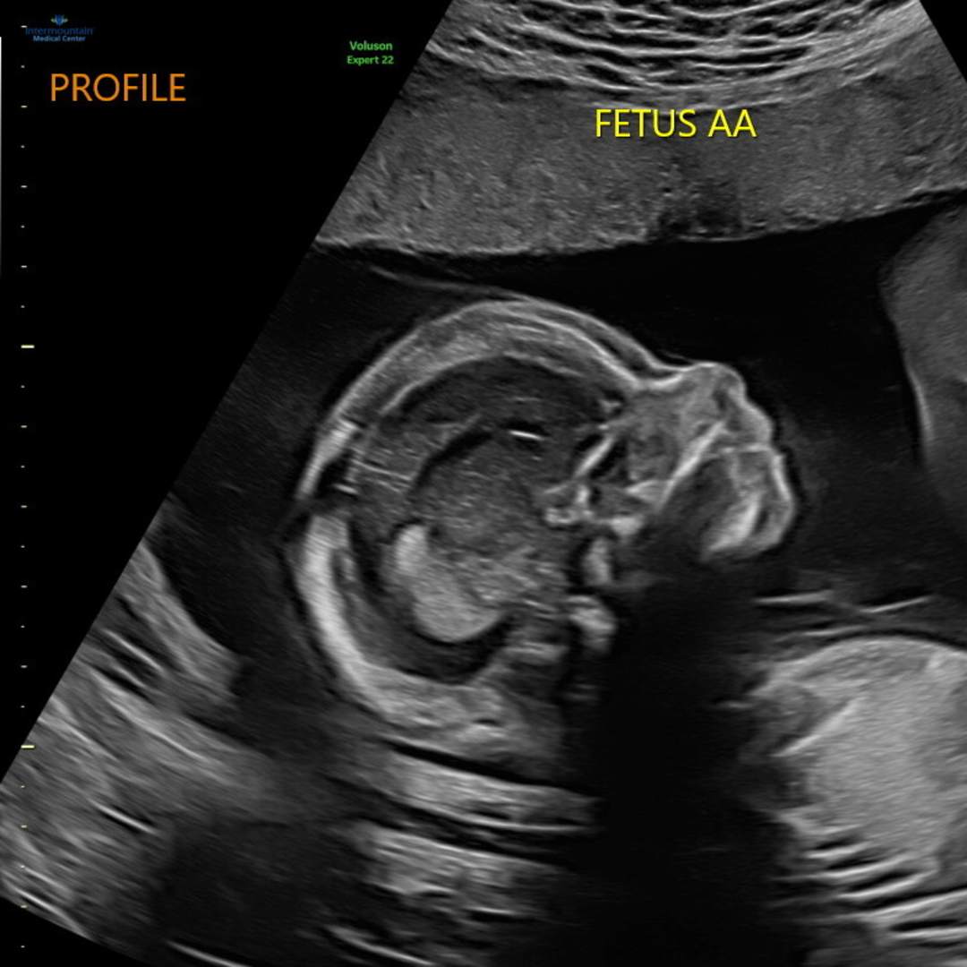 Photo shared by Cyreil for their Babylist baby registry.