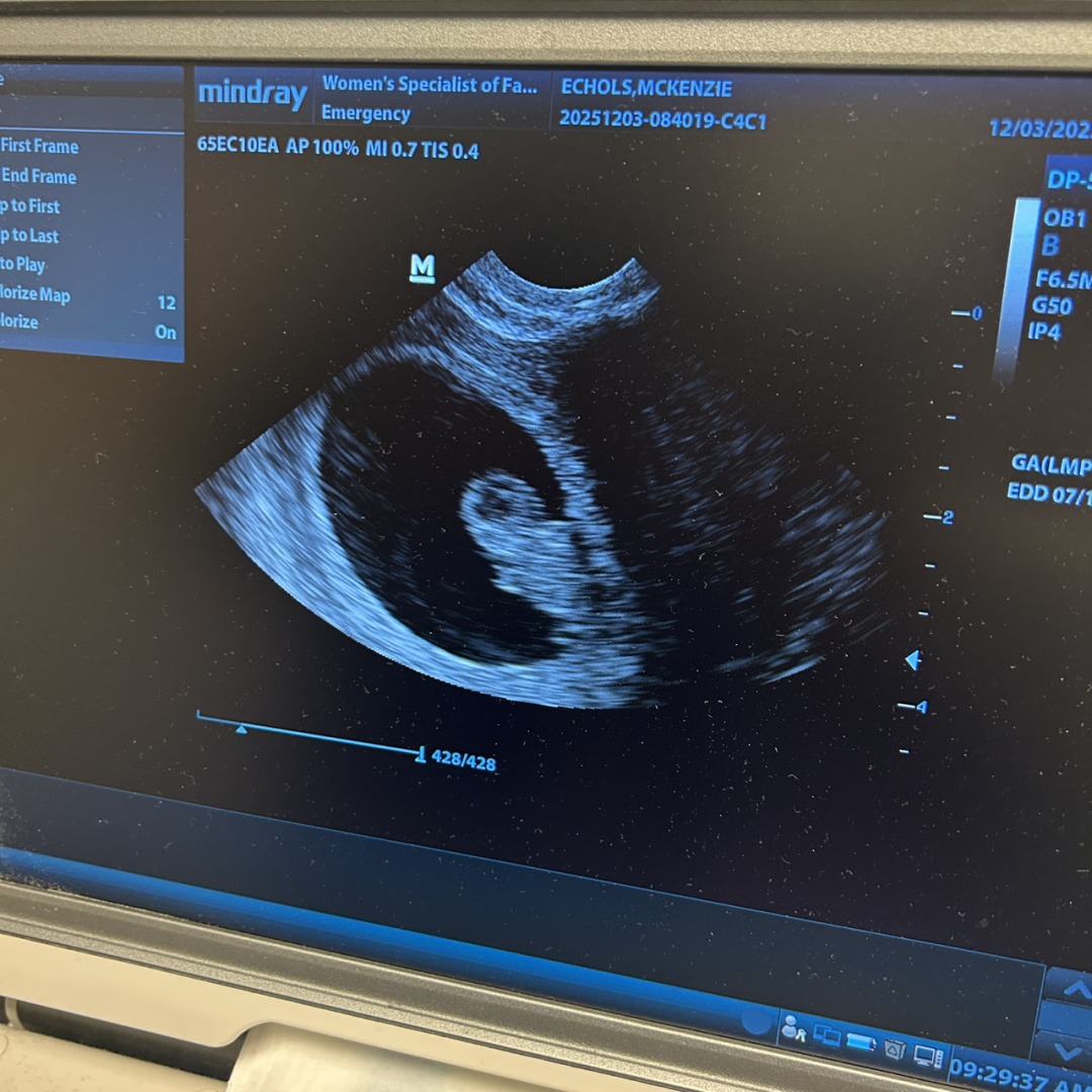Photo shared by Mckenzie for their Babylist baby registry.