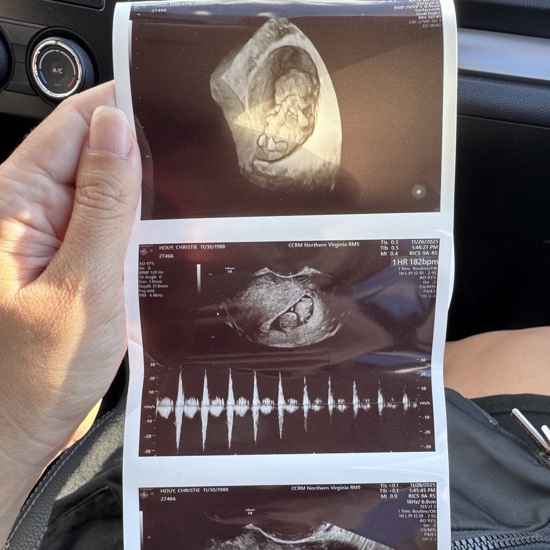 Photo shared by Christie for their Babylist baby registry.