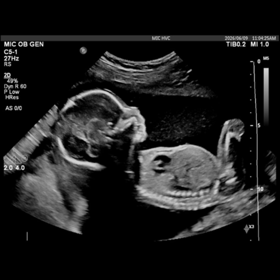 Photo shared by Alex for their Babylist baby registry.