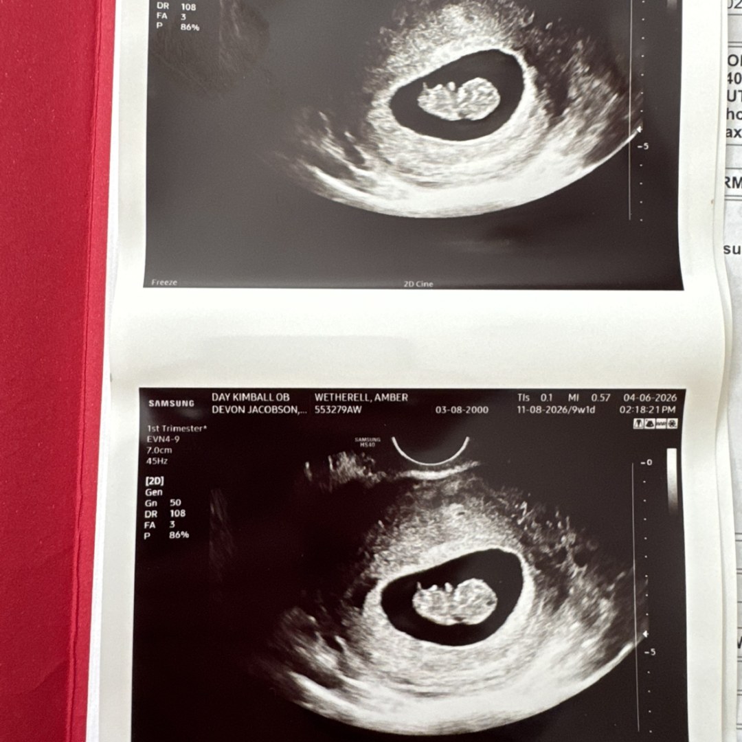 Photo shared by Amber for their Babylist baby registry.