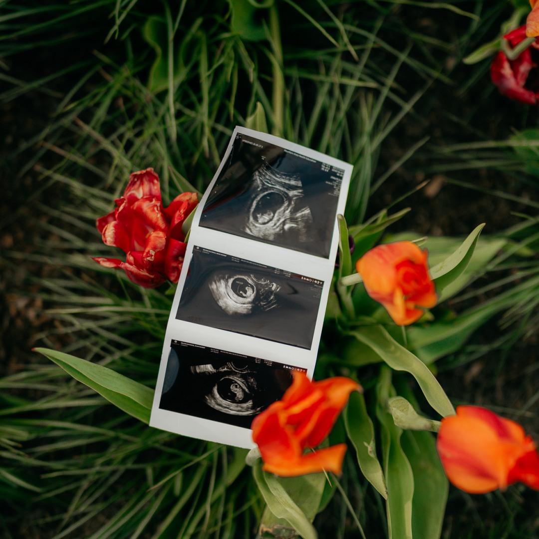 Photo shared by Monse for their Babylist baby registry.