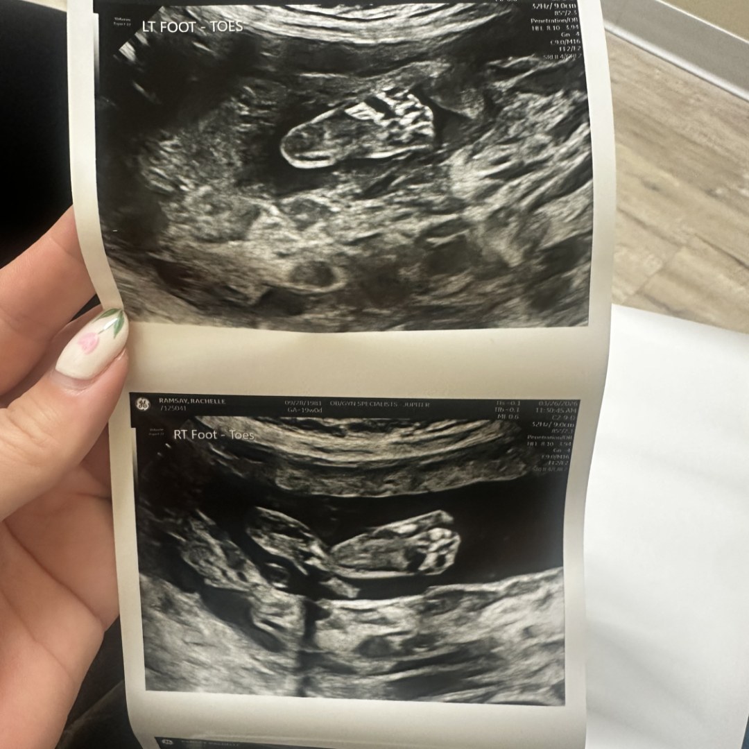 Photo shared by Zoe for their Babylist baby registry.