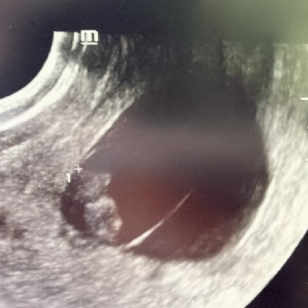 Photo shared by Corey for their Babylist baby registry.