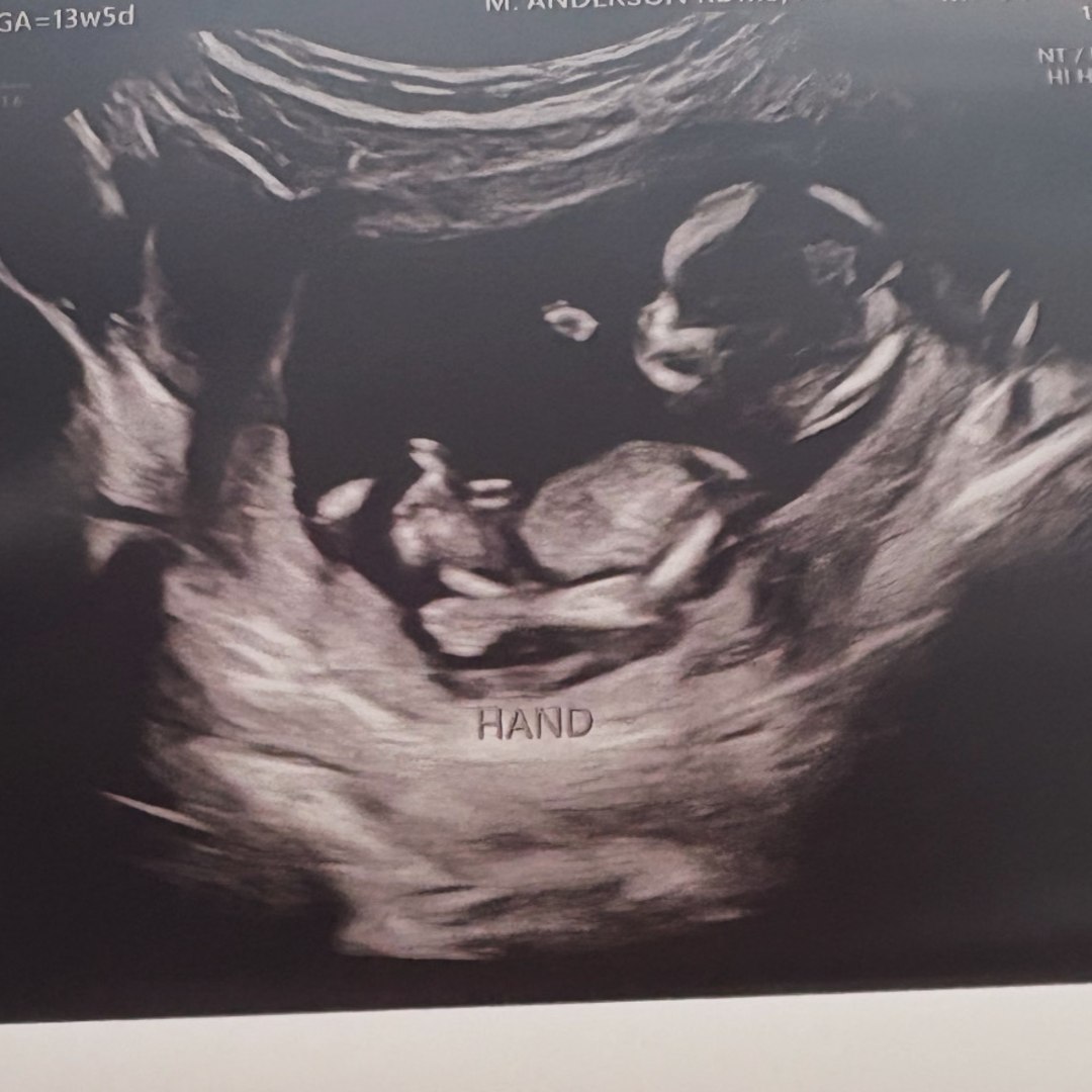 Photo shared by Jer’ziyah for their Babylist baby registry.