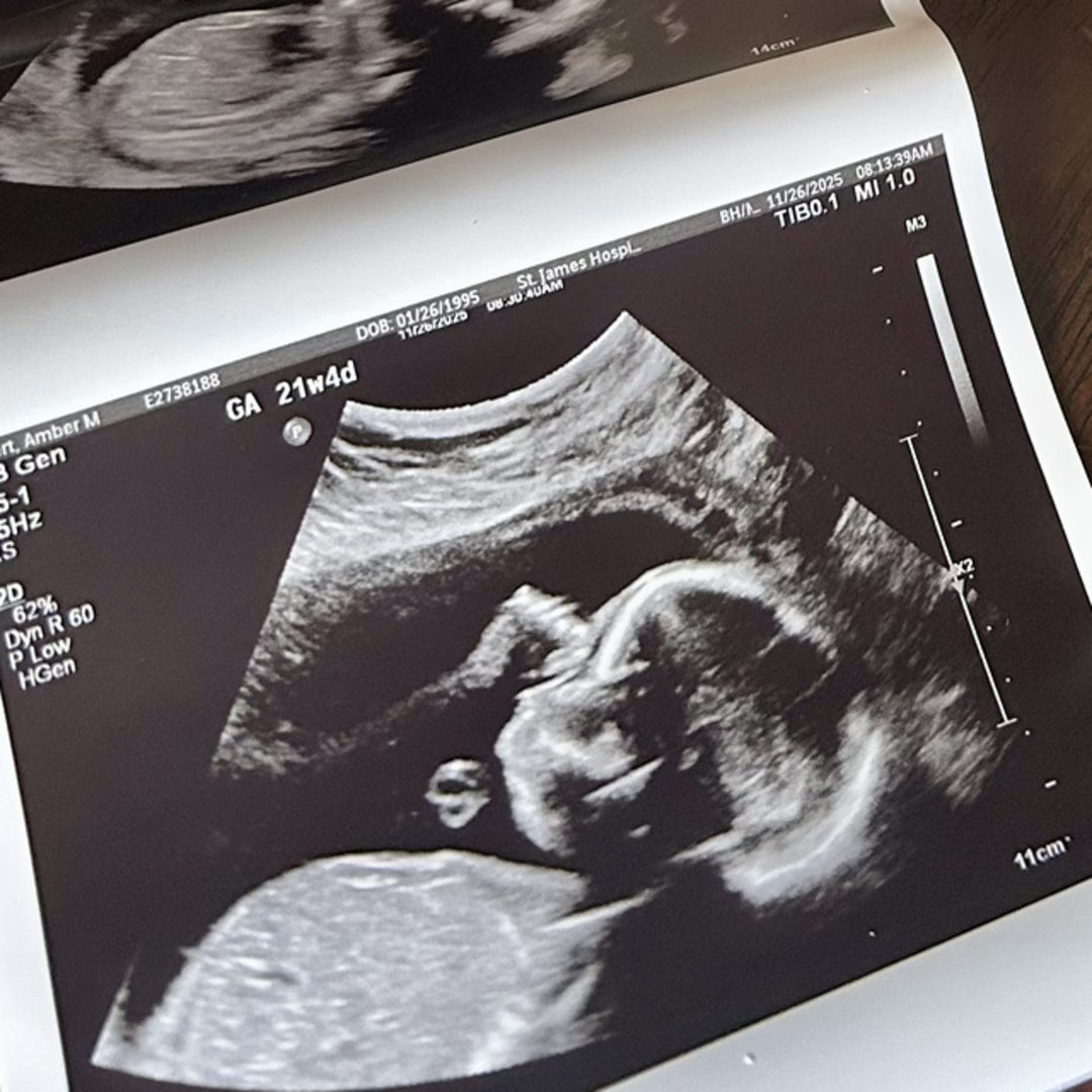 Photo shared by Amber for their Babylist baby registry.