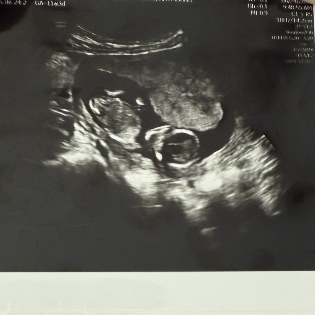 Photo shared by Kristine for their Babylist baby registry.