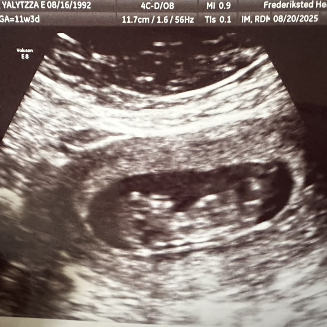 Photo shared by Yaly for their Babylist baby registry.