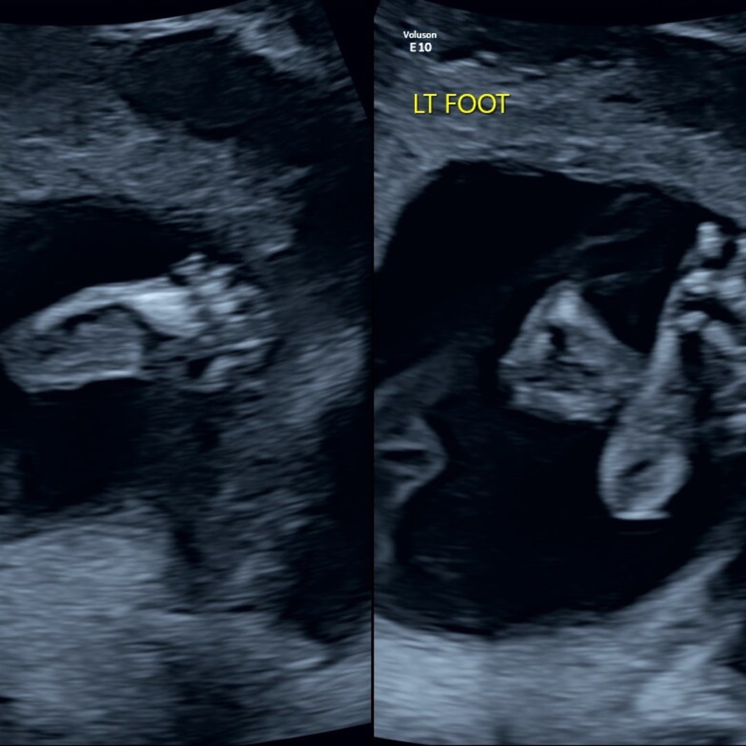 Photo shared by Zaria for their Babylist baby registry.