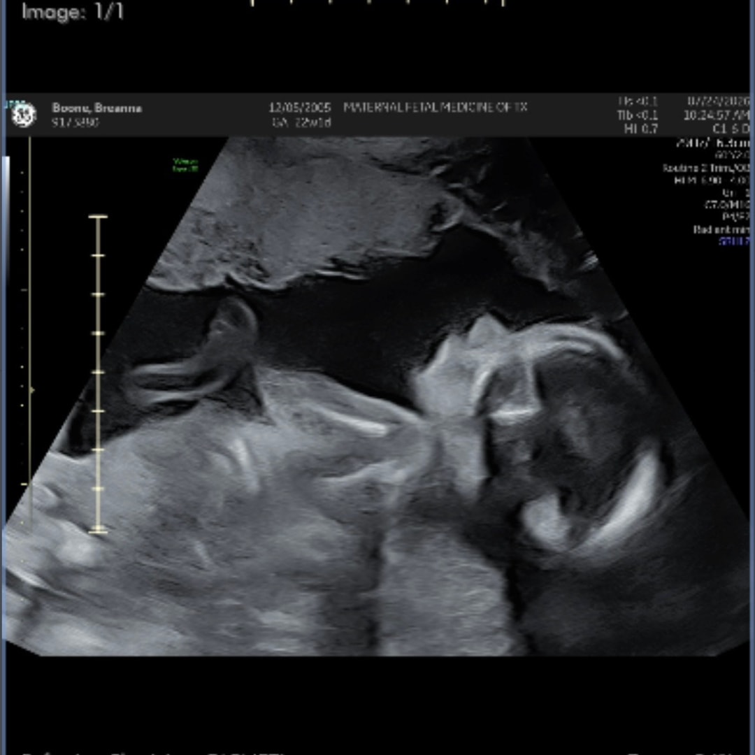 Photo shared by Breanna for their Babylist baby registry.