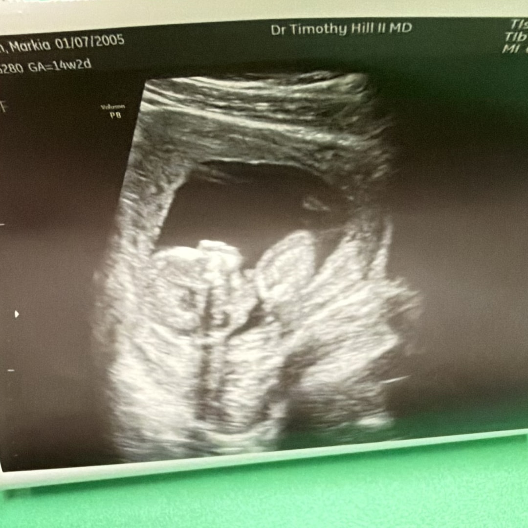 Photo shared by Markia for their Babylist baby registry.