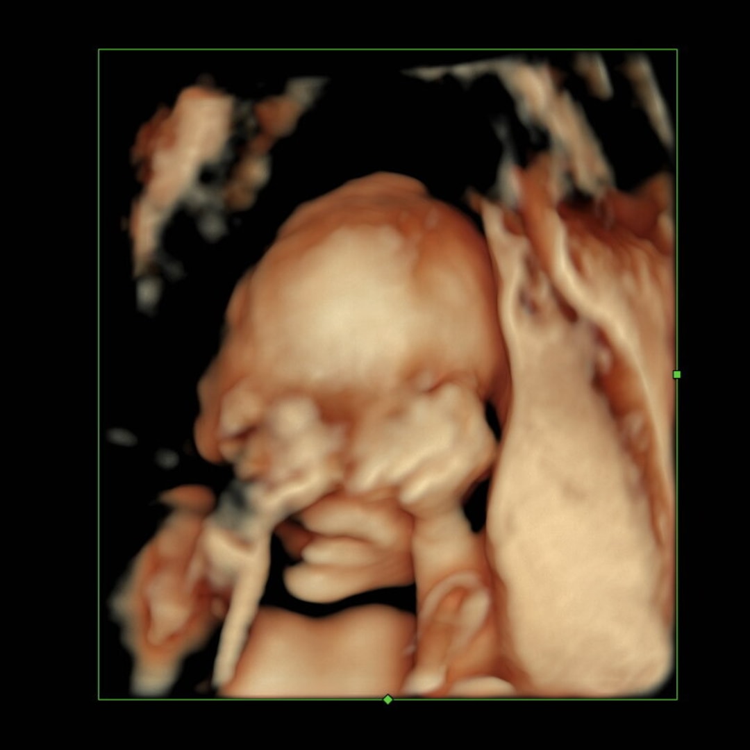Photo shared by Dustie for their Babylist baby registry.